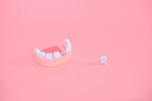 Denti mancanti, cosa accade se non li sostituisci