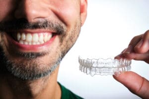 apparecchio invisibile costi alternative e prezzi di invisalign