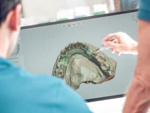 impianti dentali con poco osso soluzioni e costi